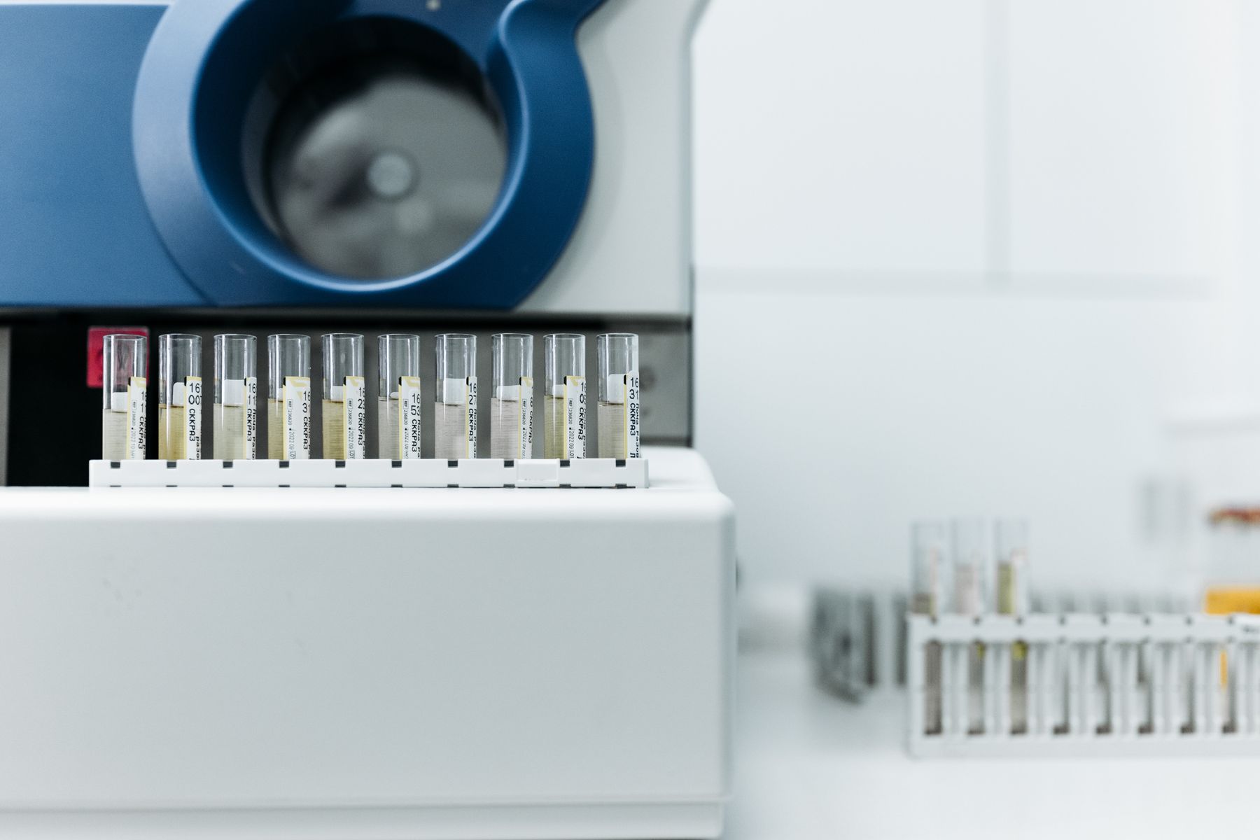 Laboratory test tubes arranged beside testing equipment